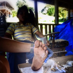 Shirlene Wood takes care of all the wounds the community brings to her (and trust me, it keeps her busy!). One of the big problems is that people leave their machetes in the mangroves (muddy, mucky area where they live) and kids step on them.  That is what happen to this little boy. Shirlene worked really hard to make this wound as clean as it looks here in the photo.   