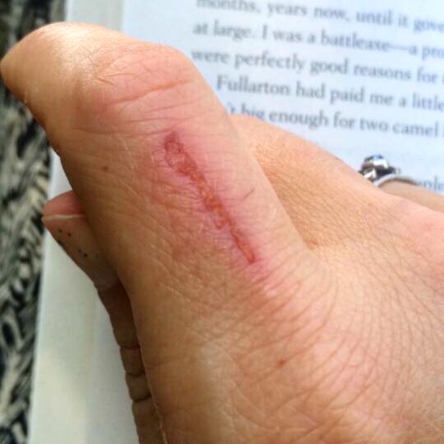 Can you believe a nice green plant did this to me?